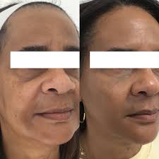 Christine Ibrahim MD, MPH (@drchristineibrahim) · Beverly Hills, CA