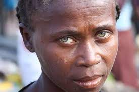 I think only around 1/6 of the worlds population has blue eyes. The Truth Behind Black Africans With Blue Eyes