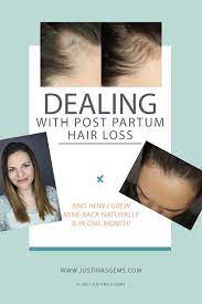 It is important to remember that the hair loss may be delayed by three months following the hormonal change and another three months will be required for new growth to be fully achieved. Pin On Natural Hair
