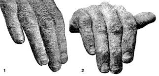 Image result for Mees Line