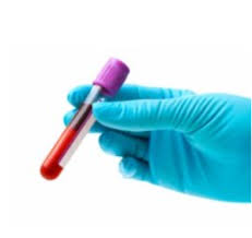 Certo che se ti chiami italiano doc non dovresti avere se acquisti una macchina nuova e la scegli rossa potrebbero pensare che sei comunista ma, se l'auto ã¨ usata, ã¨ evidente che non hai scelto tu il colore. Coronavirus 1 239 Nuovi Casi Eta Media 45 Anni I Decessi Sono 20 Piana Notizie