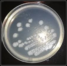 Image result for pseudomonas savastanoi pv nerii oleander symptoms