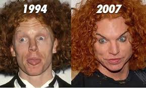 10 Famous Men With Horrible Plastic Surgery Bad Celebrity Plastic Surgery Plastic Surgery Gone Wrong Bad Plastic Surgeries