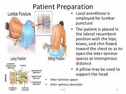 Well, a spinal tap, also known as a lumbar puncture, is a medical procedure that consists of inserting a long needing into your lower back (lumbar region). Lumbar Puncture Patient Preparation Patient Education Lumbar Puncture Health Education