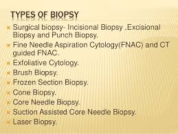Prostate biopsy samples can be collected in different ways. Biopsy Oral Pathology
