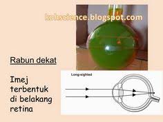 Rabun jauh ( miopia ) adalah gangguan penglihatan berupa ketidak mampuan melihat objek yang jauh sementara objek disekitarnya dapat terlihat dengan jelas. Azizah Ao590404 Profile Pinterest