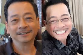 Diễn viên làm răng sứ và cơ hội đổi đời cho nhiều người