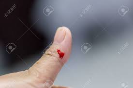 5 / 5 51 мнений. Closeup View Of Finger On Left Thumb Human Hand Is Cut Hurt And Stock Photo Picture And Royalty Free Image Image 79515548