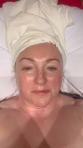 This peptide peel is a powerful, year-round skincare solution, designed to  mimic the effects of Botox while offering deep rejuvenation and hydration.  Suitable for all skin types, including the ...