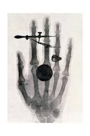 Wilhelm Roentgen S X Ray Photograph Of His Wife S Hand 1896 Giclee Print Wilhelm Conrad Rontgen Art Com In 2020 Giclee Print Culture Art Travel Art