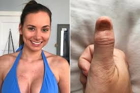 Breast cancer is the second most common cancer found in women — after skin cancer — but that doesn't mean men aren't at risk as well. Beauty Queen Discovers Bruise On Her Finger Is Rare Deadly Skin Cancer