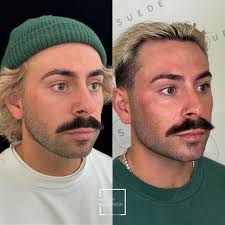 Injectables by Hayley