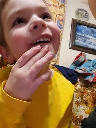 So I've always wondered. Did they peel the outside skin