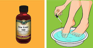 What is the essential oil of tea tree? Tea Tree Oil Is Far More Useful Than You Think Here Are 7 Reasons Why You Need It At Home