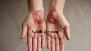 Image result for syphilis symptoms