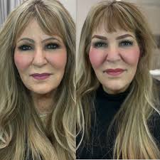 TOP 10 BEST Microchanneling near Natomas, Sacramento, CA