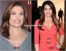 The trump family can deny their plastic surgeries all they want,. Plastic Surgery V Twitter New Post Kimberly Guilfoyle Plastic Surgery Before After Has Been Published On Celebrity Plastic Surgery Https T Co Kqkl6srcwo Https T Co Fvph7tdvuh