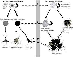 In general, brain tumors are more common among older people, but statistics even show an increase in brain tumors in kids. Normal Cns Differentiations And Cns Tumor Formation During Normal Download Scientific Diagram