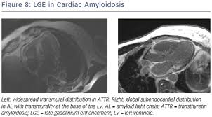 More specifically, it is described as. The Role Of Cardiovascular Magnetic Resonance Imaging In Heart Failure Cfr Journal