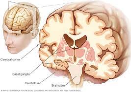Cause Of Supranuclear Palsy Mayo Clinic