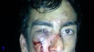 Carnaval En La Repu Denuncian Que Un Hombre Fue Golpeado Brutalmente Por Agentes Municipales Politica Y Medios