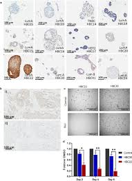 115 просмотров 3 года назад. Evaluation Of Fgfr Targeting In Breast Cancer Through Interrogation Of Patient Derived Models Breast Cancer Research Full Text