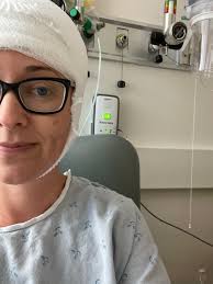 Hello from the other side of brain surgery — The Liz Army: Bringing punk  rock to health care