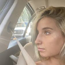 DAVID L. CANGELLO, MD, FACS