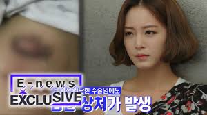 Han Ye Seul Had Surgery, But the Wounds were Bad [E-news Exclusive Ep 64]