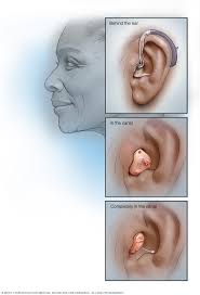 Image result for Hearing Aid
