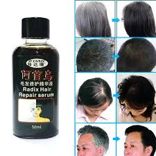 And it's not just because they are black. 1pcs 50ml Traditional Chinese Medicine Cure White Hair Turn Gray Black Liquid Juvenile Loss Care Oil Treatment Hair Loss Product Aliexpress