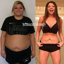 Pin On Weight Loss Tips