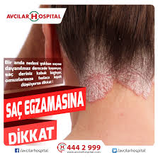 Sac Derinizde Pul Pul Dokulme Kizariklik Ve Kasinti Olarak Ortaya Cikar Ve Diger Adiyla Seboreik Dermotit Olarak Da Bilinir Genel Olara Sac Sac Bakimi Deri