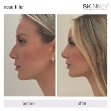 As a women founded + led medspa, it was an honor to have Carrie Storm at  our 57th Street location! 🤩 Carrie Strom is the first woman to rise to the  rank