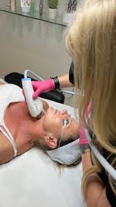 Image result for Laser Skin Procedure