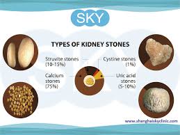 Kidney Stone Treatment