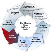 A hard lump inside your nose can be cancer — and there are numerous different kinds of cancers that can a hard lump inside the nose is most likely a variation of normal nasal anatomy, says dr. Nasal Obstruction Symptoms Causes Treatment Fort Worth Ent