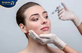 Tiêm filler thái dương bị vón cục: Nguyên nhân và cách khắc phục