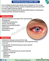 Image result for Vernal Conjunctivitis