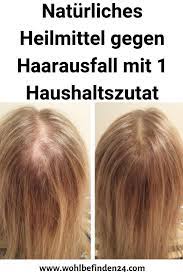 Naturliches Heilmittel Gegen Haarausfall Mit 1 Haushaltszutat Frisurenfurstuf Haarausfall Haare Pflegen Frisuren Bei Haarausfall
