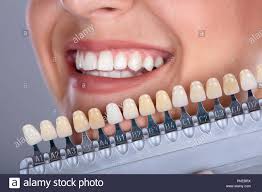 Dental Shade Stock Photos Dental Shade Stock Images Alamy