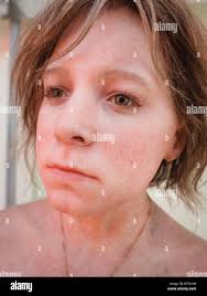 Wax dummy immagini e fotografie stock ad alta risoluzione