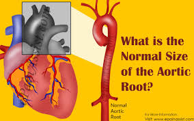 What Is The Normal Size Of The Aortic Root