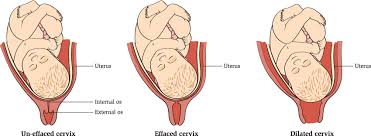How far can you dilate without feeling contractions? Labour Progress Prenatal Education