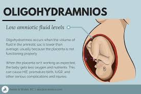Pin On Pregnancy Health