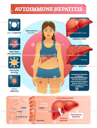 Pin On Health And Medicine Illustrated