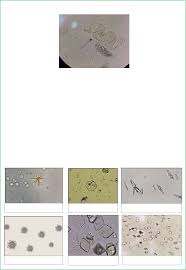 Grátis: Atlas de Urinálise - Material Claro e Objetivo em PDF para Estudo  Rápido