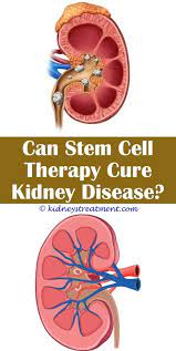Account Suspended Kidney Disease Kidney Failure Causes Kidney Disease Symptoms
