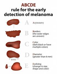 When it comes to moles, they are usually about a quarter of an inch in size, evenly coloured brown, tan or black and can be flat or raised. Moles Advanced Dermatology Skin Surgery