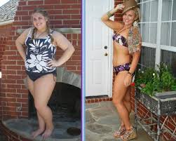 Vertical Sleeve Gastrectomy Forum Vsg Sleeve Gastrectomy Sleeve Gastrectomy Diet Vertical Sleeve Gastrectomy